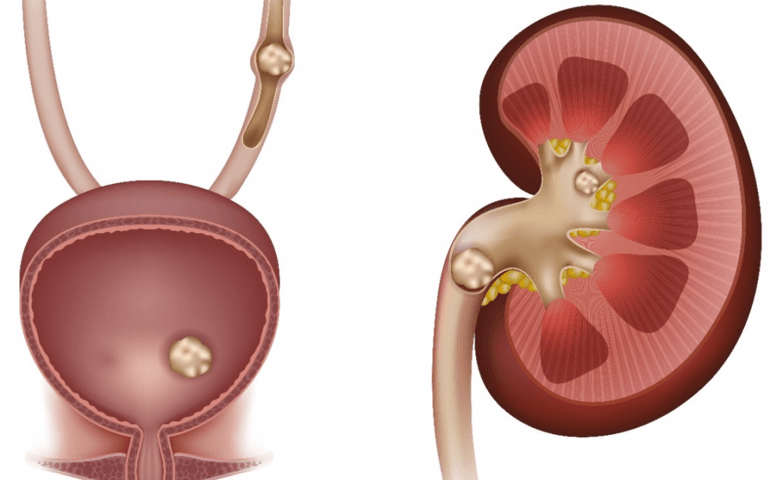 how-well-do-you-know-your-kidneys.jpg