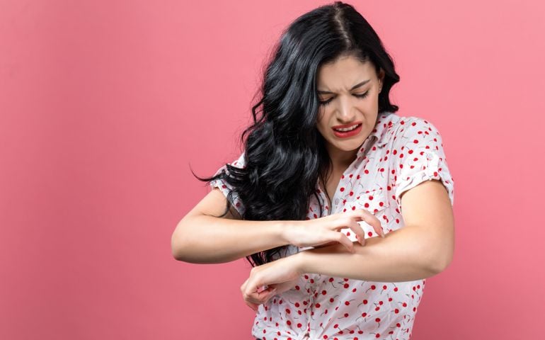 Young woman scratching her itchy arm. Skin problem.