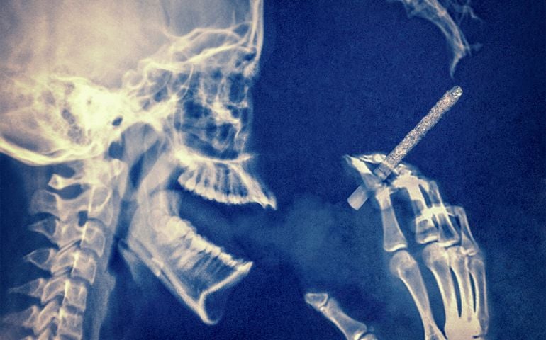 An x-ray image of a skeleton hand holding a cigarette up to a skull