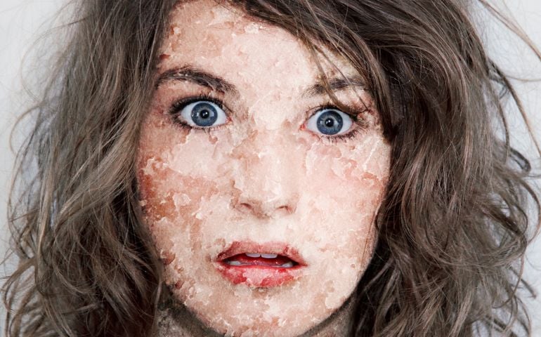 Abstract photo of a young woman with big skin problems
