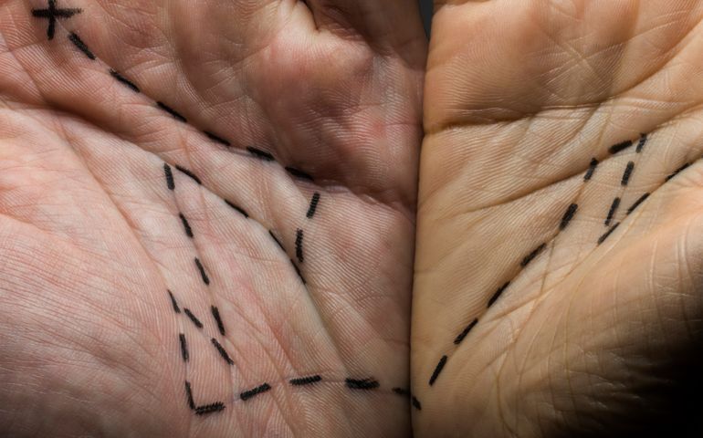 Dotted lines linking two hands,from starting point