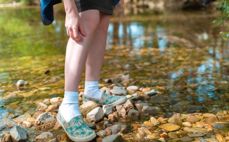 Young woman scratching her leg due to insect bite in nature. In the background trees and river