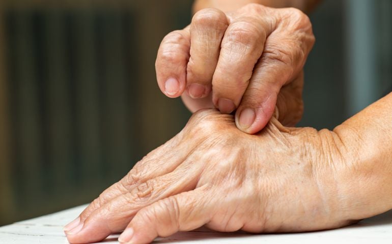 Senior Woman's right hand pinching her left hand, On white table background, Close up shot