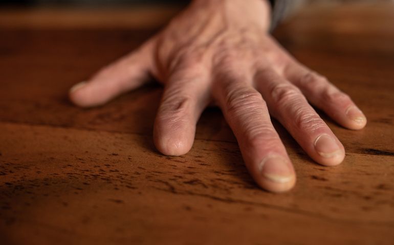 The amputated hand