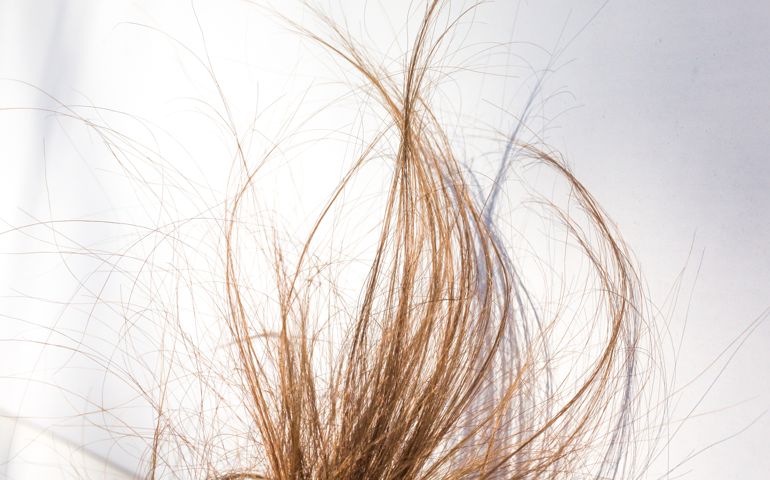 Damaged Hair, Dry Hair, Frizzy Hair Split Ends Summer Hair Problems