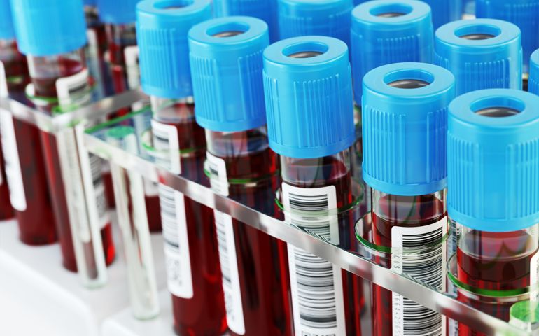 Blood test tubes
