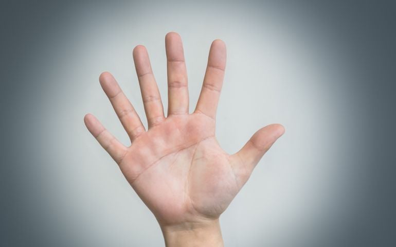 hand with six fingers, human mutation, not like everyone else, strange man, evolution. concept