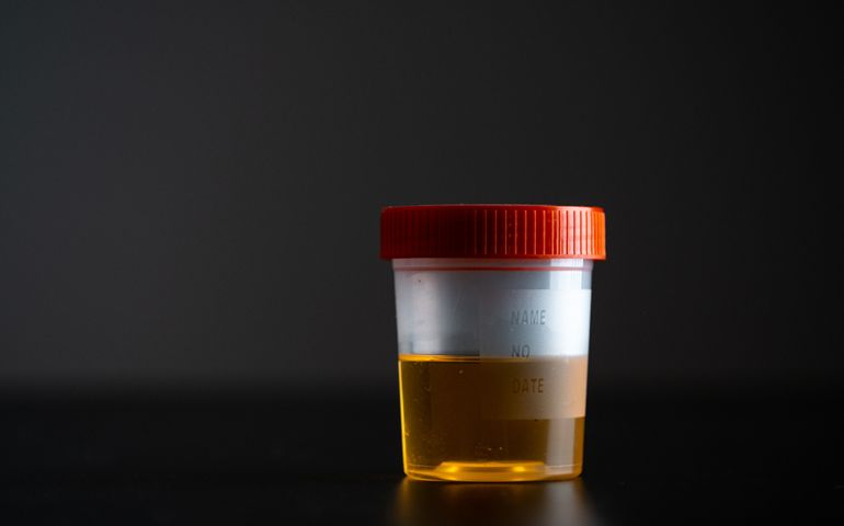 a jar with a urine test on a dark background