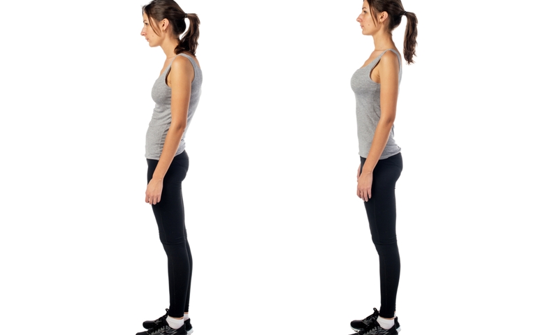Woman with impaired posture
